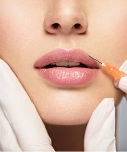 Lip Flip botox services