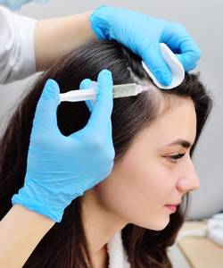 platelet rich plasma injections for hair growth