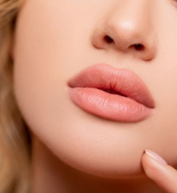 lip enhancement with dermal fillers