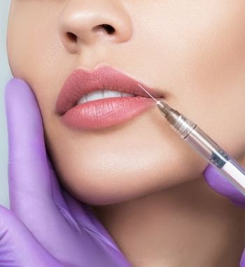 lip filler treatment to enhance lips