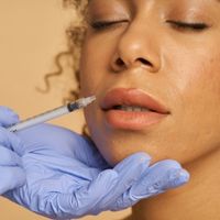 lip flip treatment with botox