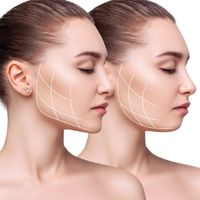 masseter reduction botox dysport