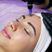 prp facial services in top ottawa medical aesthetic clinic