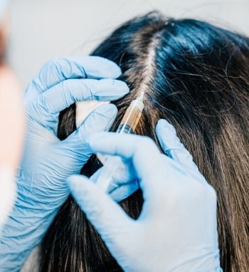 platelet rich plasma injections for hair growth