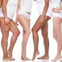 varicose and spider veins treatment helps reduce the appearance of unwanted veins on the legs