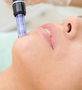 microneedling treatments and services