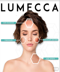 Lumecca IPL