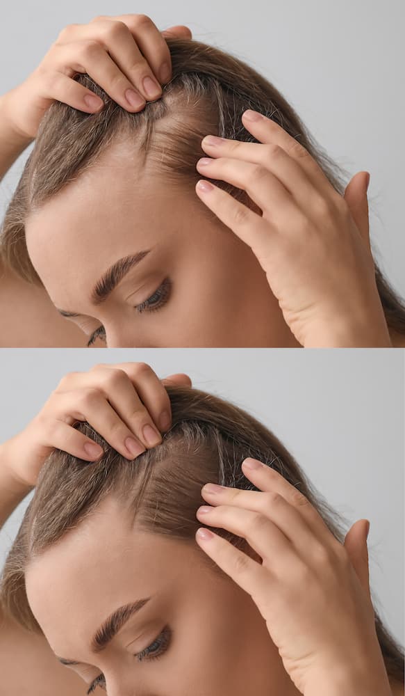 hair loss fix